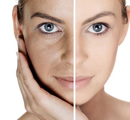Laser skin resurfacing treatment (half face)